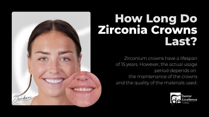How Long Do Zirconia Crowns Last? How Long Do Zirconia Crowns Last?