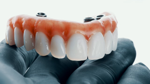 Hybrid Prosthesis: Frequently Asked Questions Hybrid Prosthesis: Frequently Asked Questions