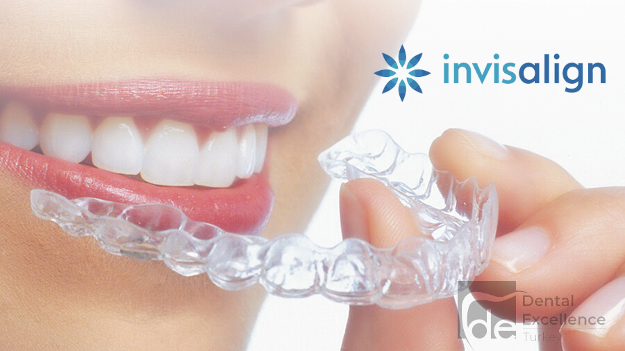 Invisalign Treatment in Turkey Invisalign Treatment in Turkey