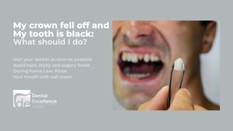 My Crown Fell Off and My Tooth is Black: What Should I Do? My Crown Fell Off and My Tooth is Black: What Should I Do?