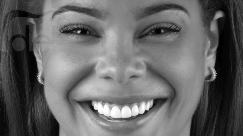 Get the Perfect Smile with E-Max® Crowns Get the Perfect Smile with E-Max® Crowns