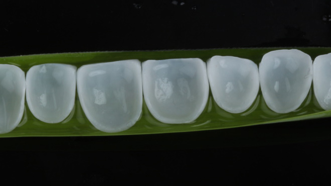 What E.MAX and Zirconia Crowns Are? What E.MAX and Zirconia Crowns Are?
