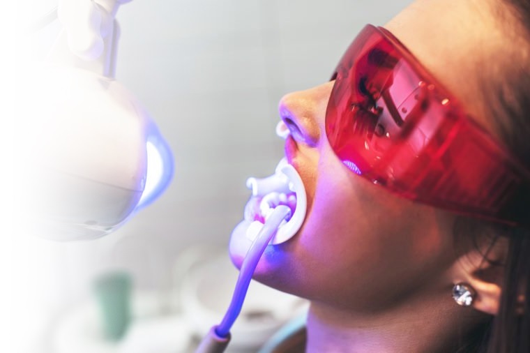 teeth-whitening teeth-whitening